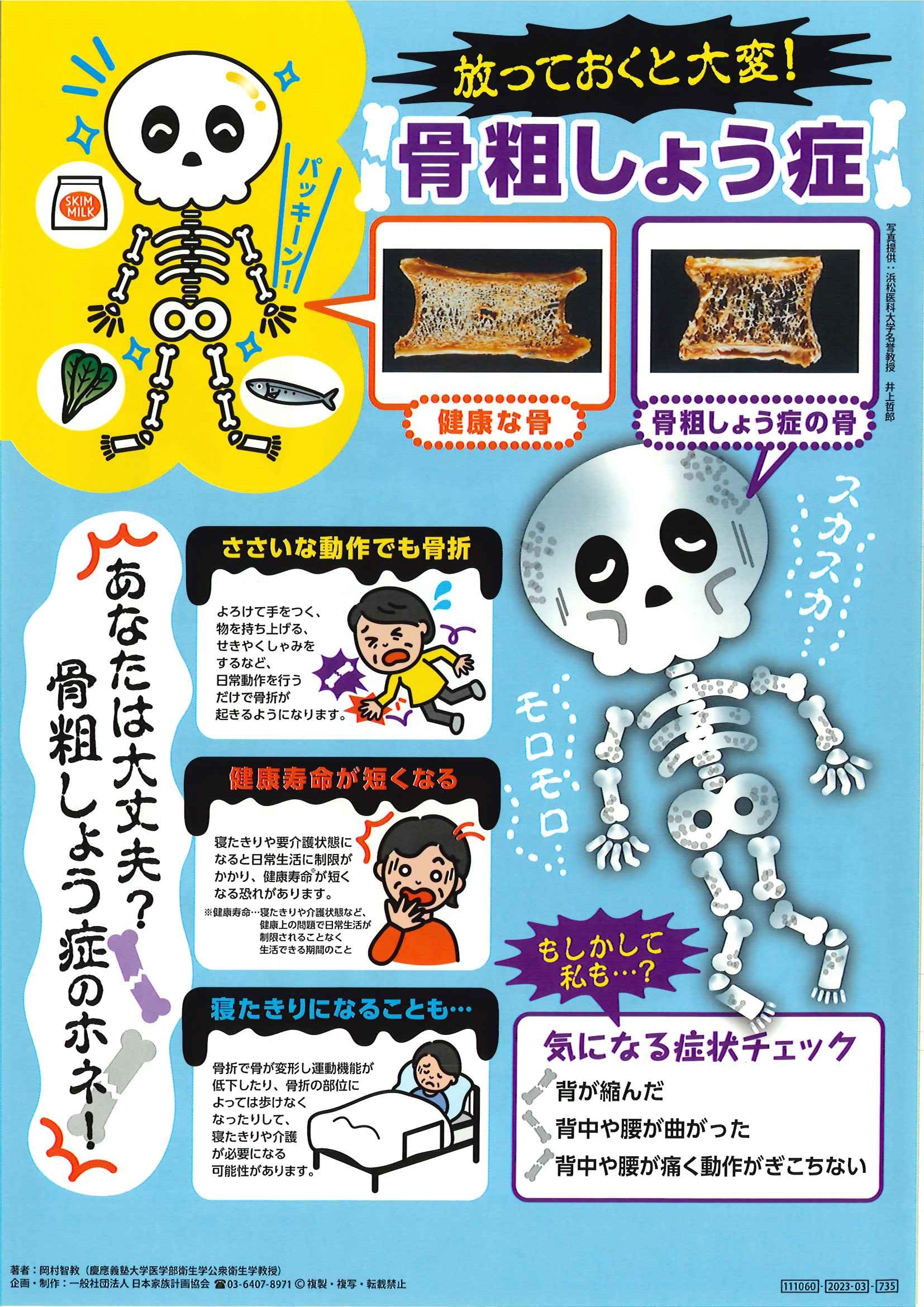 放っておくと大変！骨粗しょう症 – JFPA®オンラインショップ
