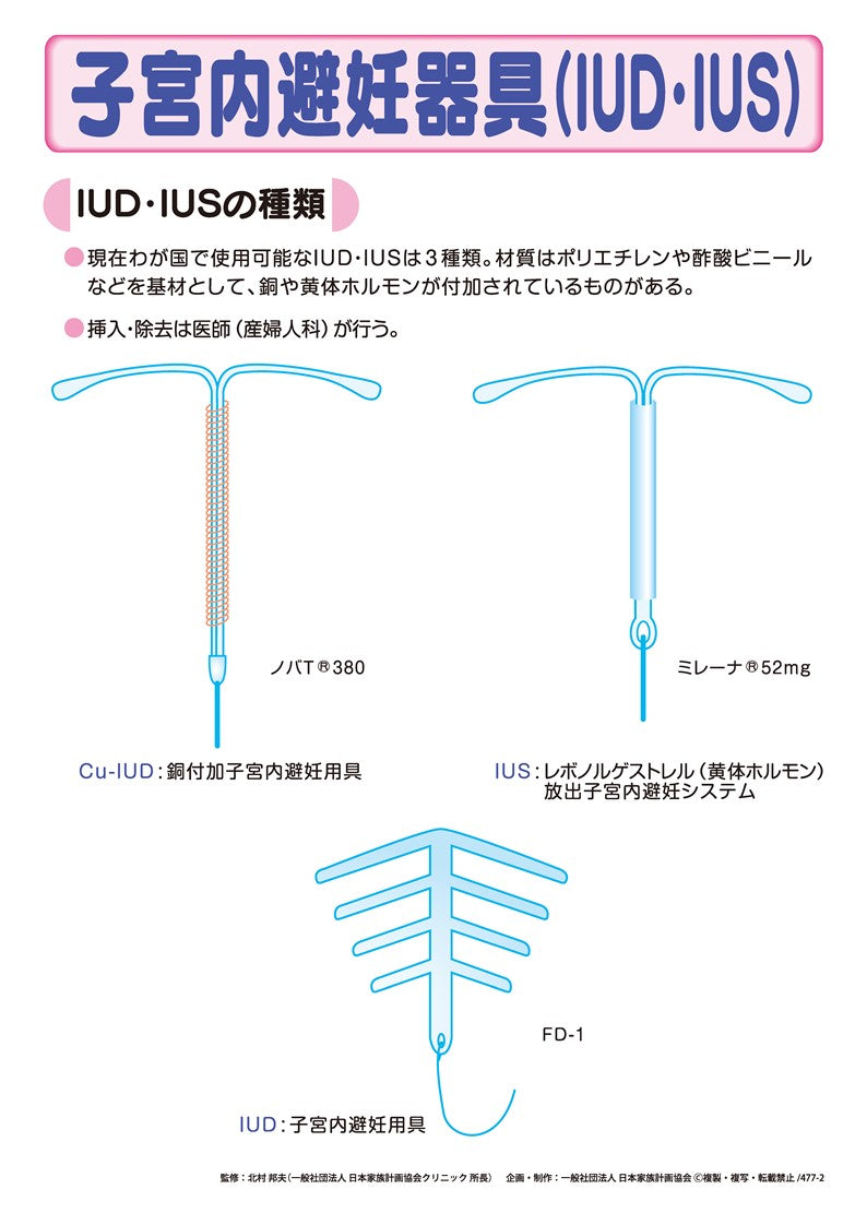 子宮内避妊器具（IUD・IUS）