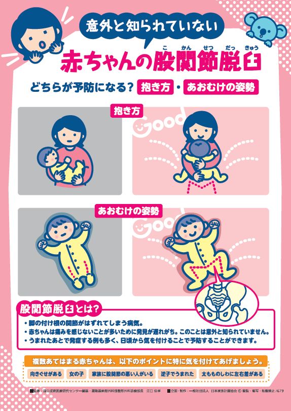 赤ちゃんの股関節脱臼 – JFPA®オンラインショップ