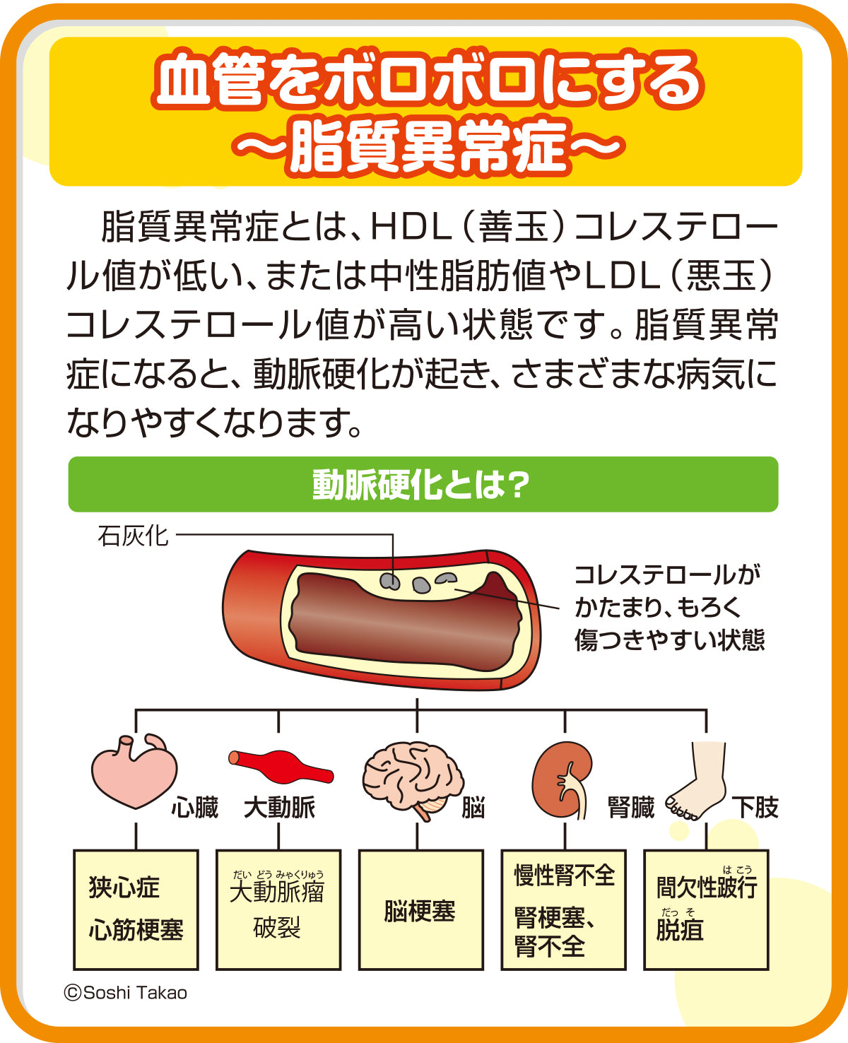 A-47 血管をボロボロにする～脂質異常症～ – JFPA®オンライン