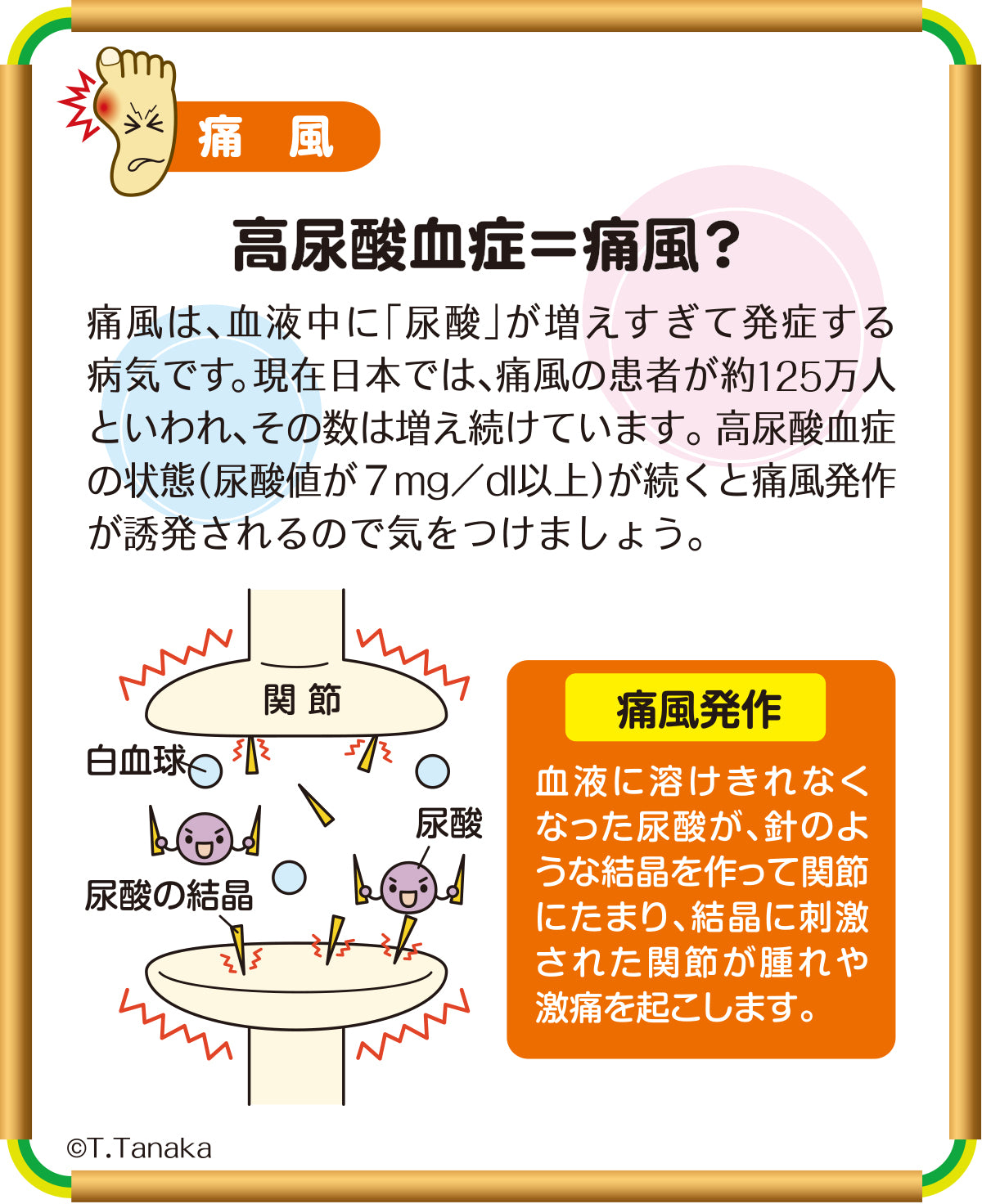 B-204 高尿酸血症＝痛風？ – JFPA®オンラインショップ