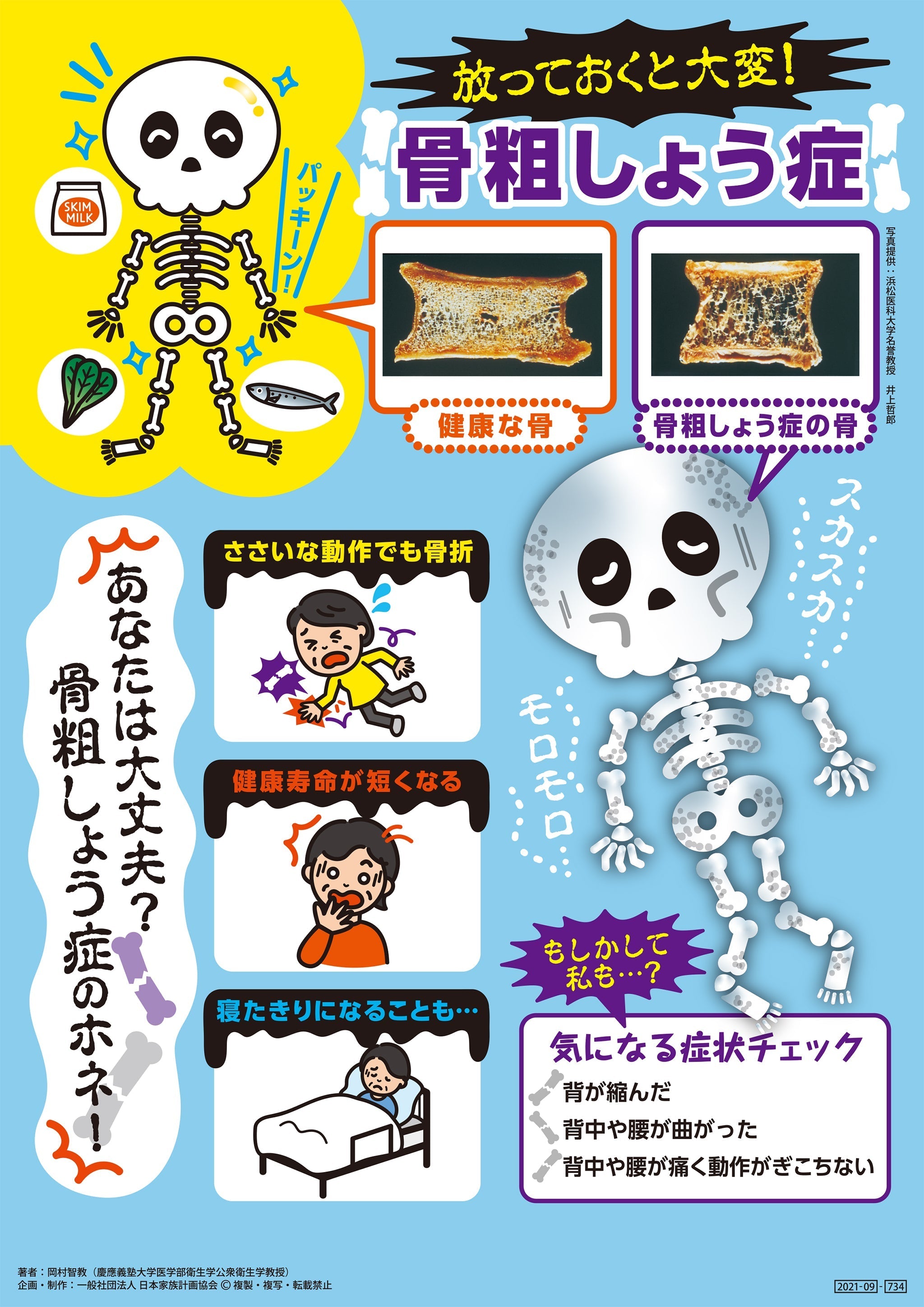 放っておくと大変！ 骨粗しょう症 文字少なめver – JFPA®オンライン