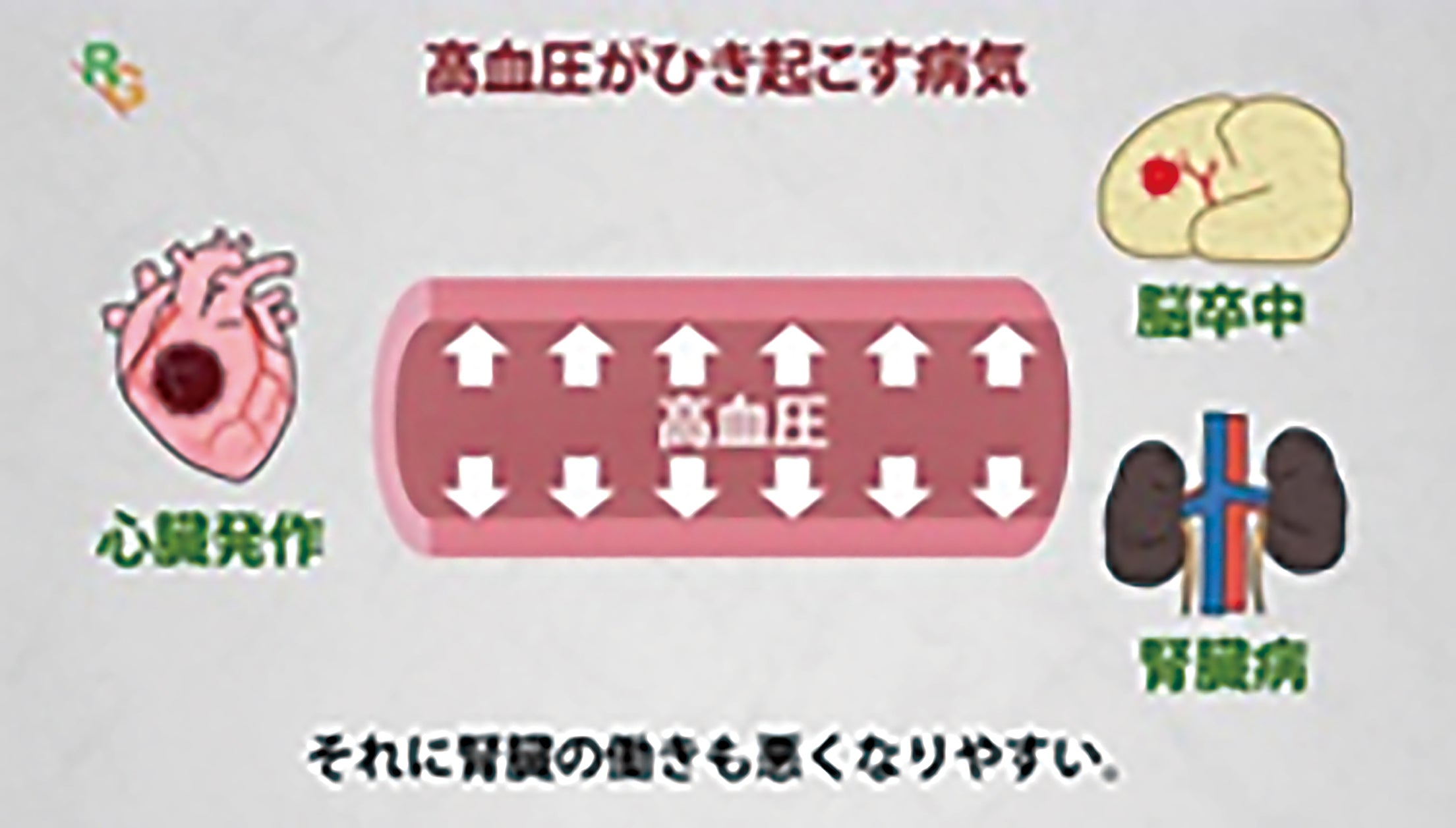 早割 リフト券 DVD「健診後・予防」編（19動画） – JFPA®オンラインショップ 健康・医学