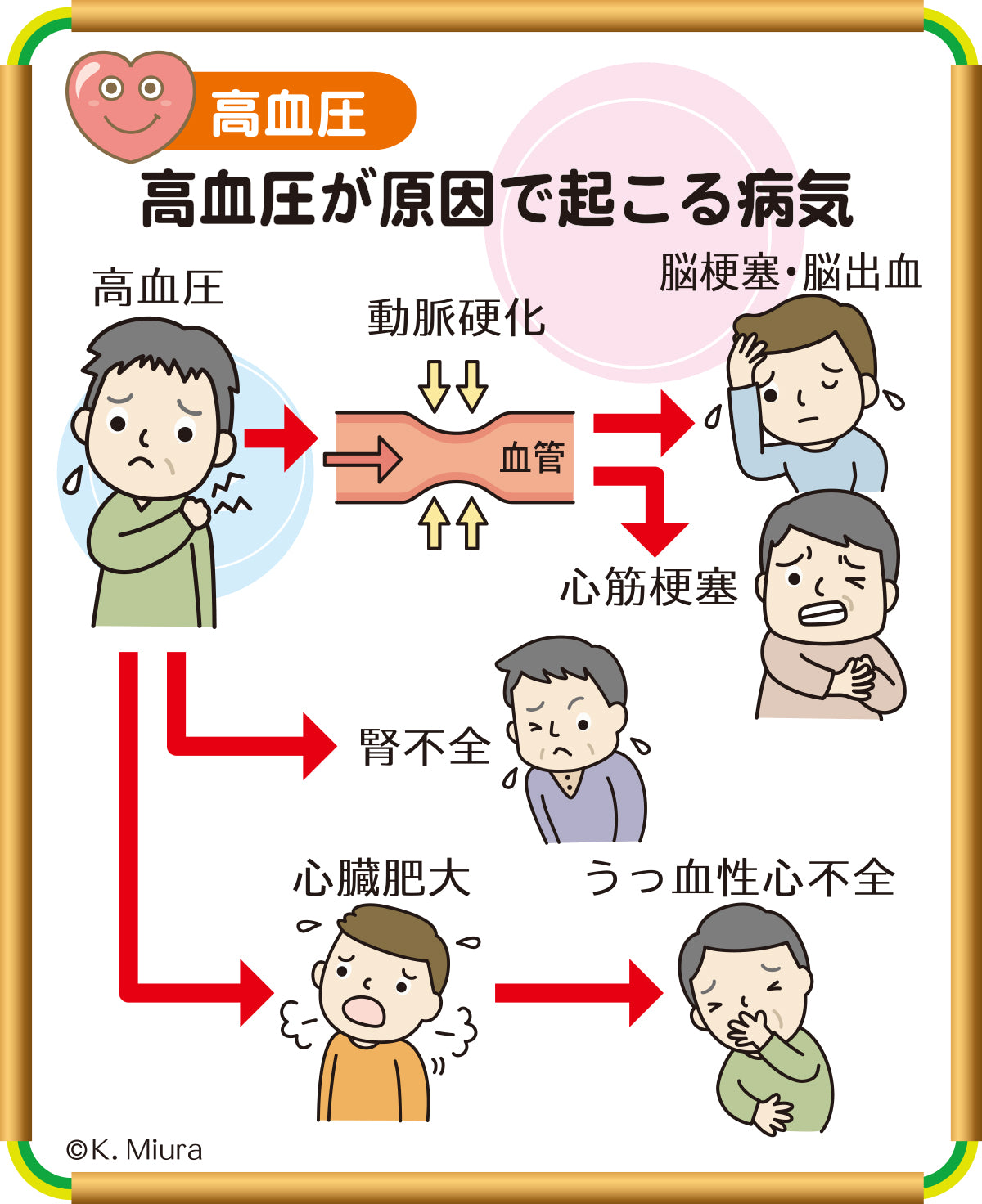 B-189 高血圧が原因で起こる病気 – JFPA®オンラインショップ